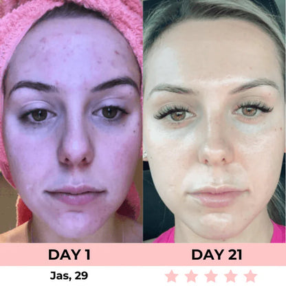 Masajeador Facial PRO. Reductor de Papada. Reafirmante de Rostro y Cuello con Luces Led. Portátil.