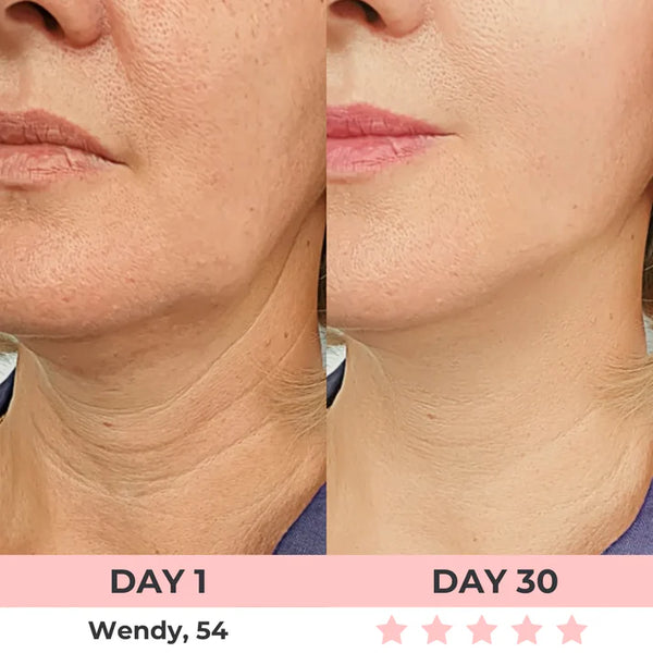 Masajeador Facial PRO. Reductor de Papada. Reafirmante de Rostro y Cuello con Luces Led. Portátil.