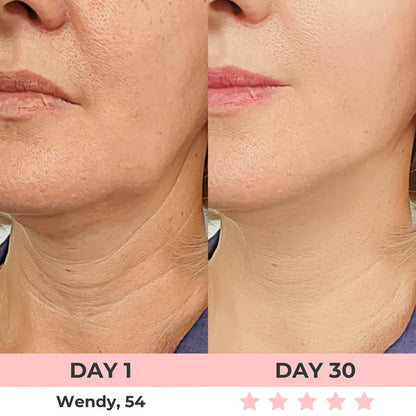 Masajeador Facial PRO. Reductor de Papada. Reafirmante de Rostro y Cuello con Luces Led. Portátil.