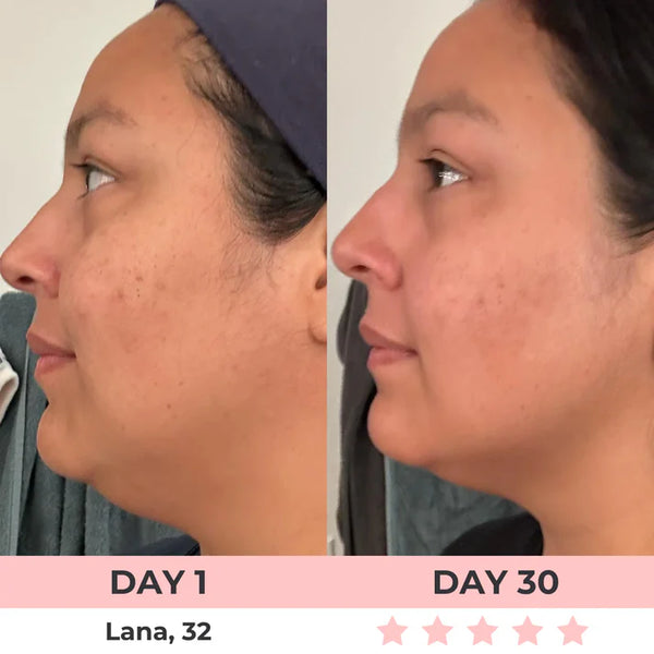 Masajeador Facial PRO. Reductor de Papada. Reafirmante de Rostro y Cuello con Luces Led. Portátil.