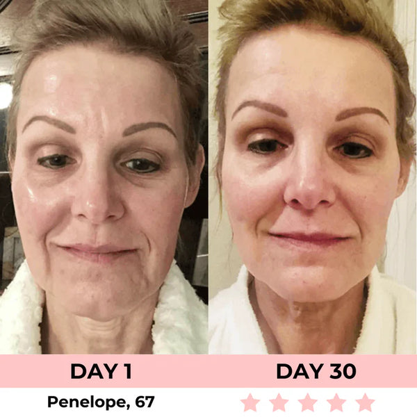 Masajeador Facial PRO. Reductor de Papada. Reafirmante de Rostro y Cuello con Luces Led. Portátil.